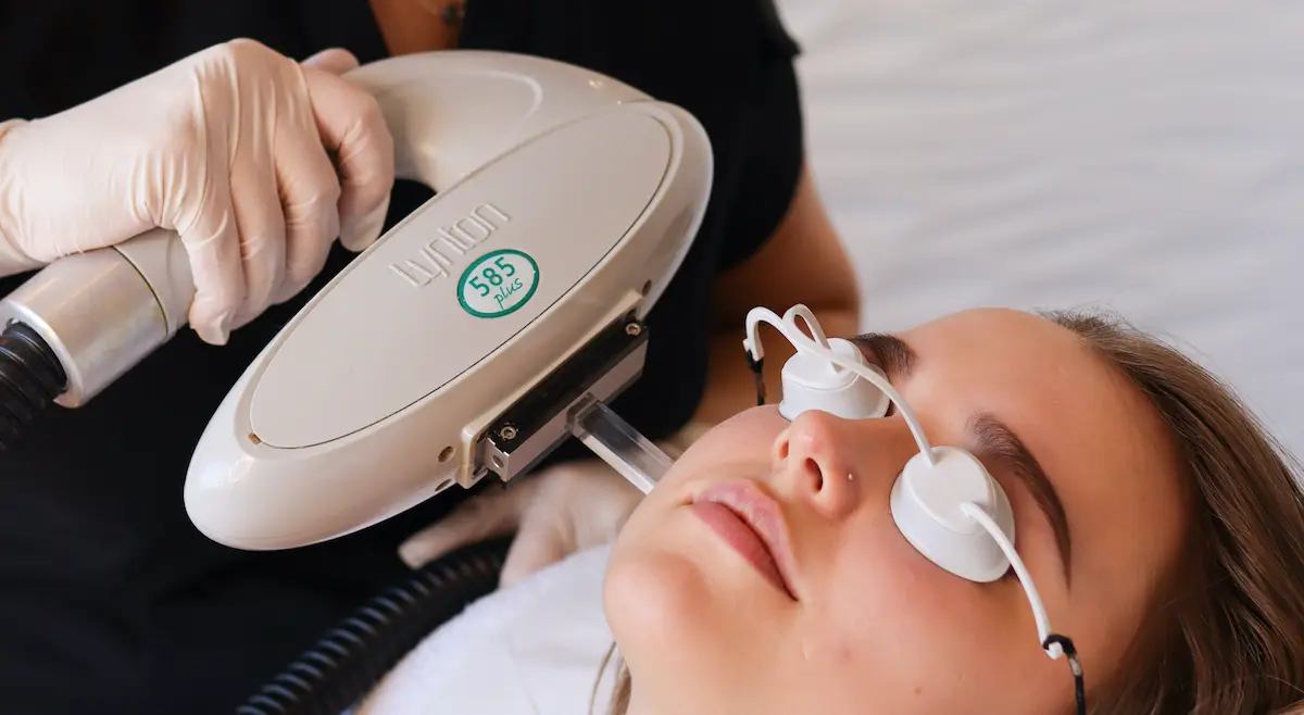 intense pulse light therapy