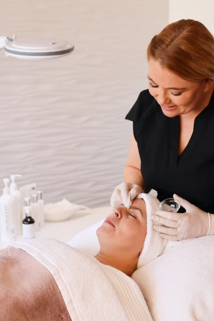 chemical peel Teddington