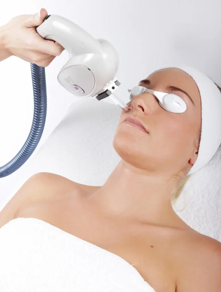 IPL treatment Teddington